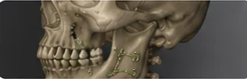 Cirugía Maxilofacial